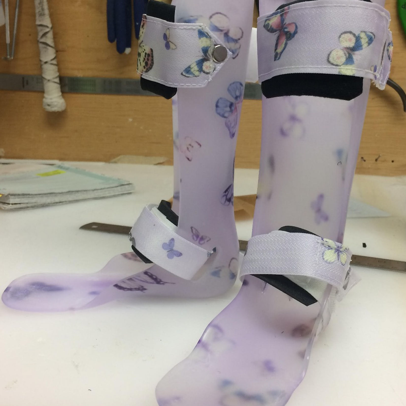 Bilateral rigid pediatric AFOs with purple butterflies pattern