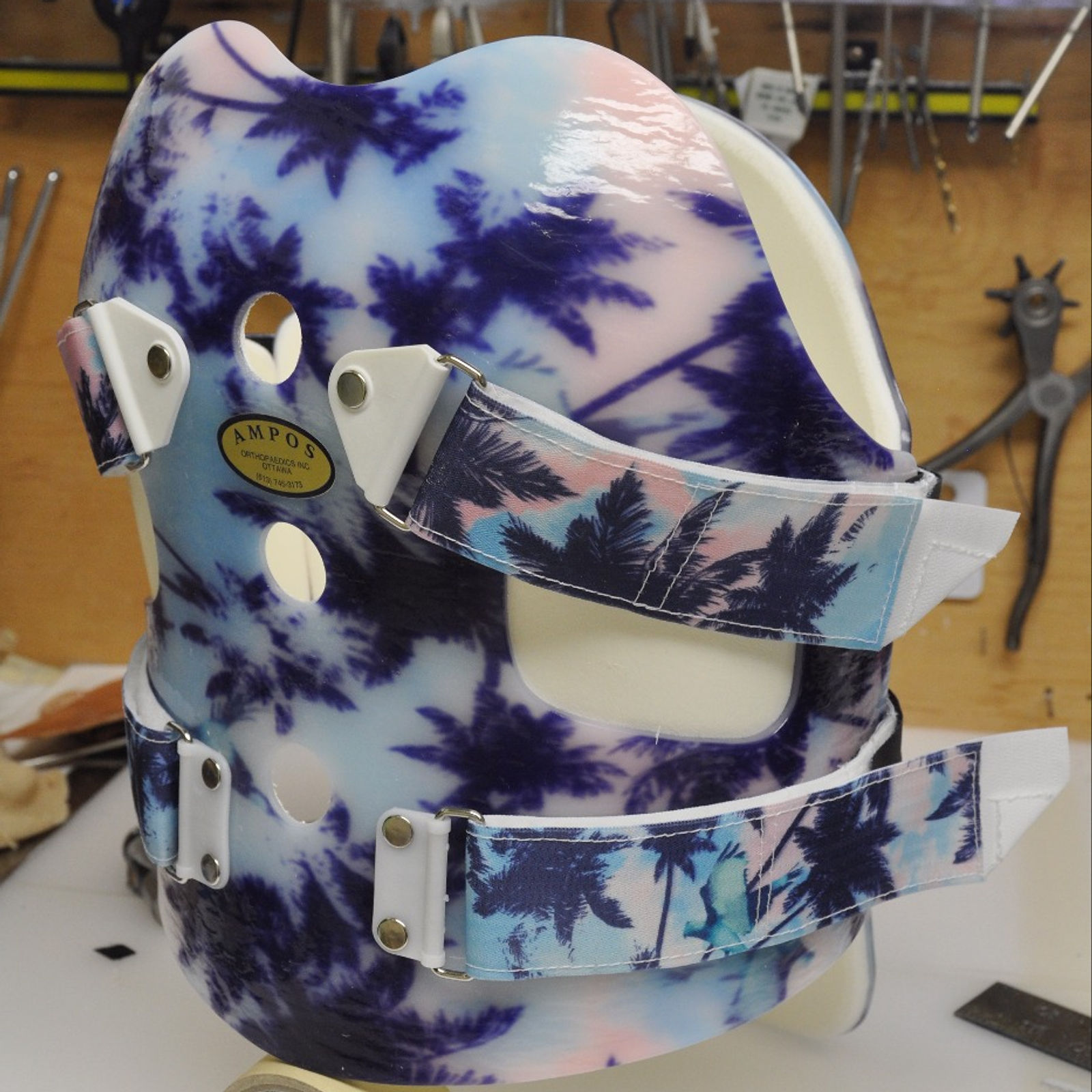 Tropical Palm Tree TLSO (Front)