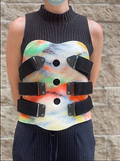 Thoracic-Lumbo-Sacral Orthoses (TLSO) example